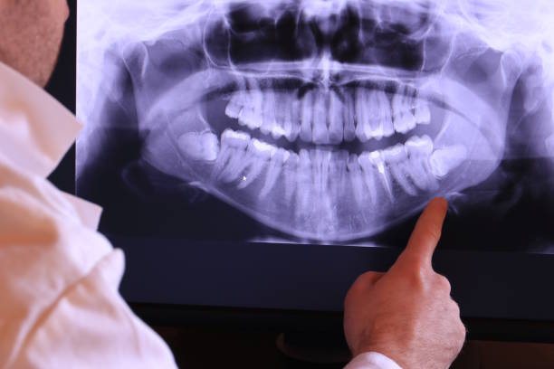 Best Emergency Wisdom Teeth Removal in Edgar, WI